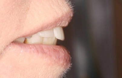 Smile gallary image - After